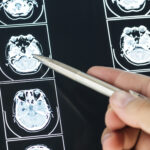 Medical Trauma